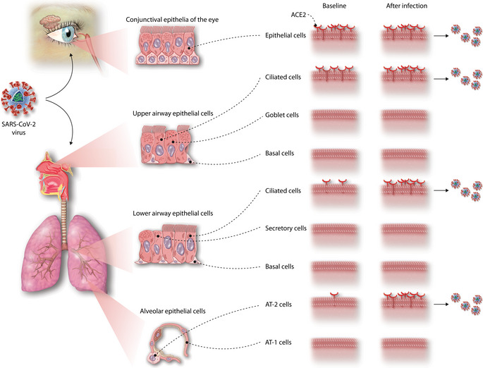 Respiratory Tract as the entry site for SARS-CoV-2
